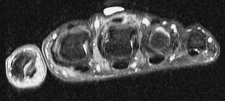 Figure 2 for case Boxers knuckle